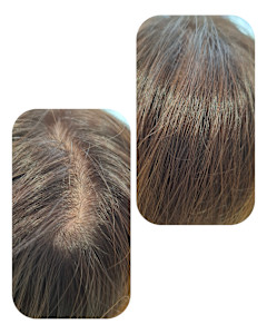 話題のトキカタ♪頭頂部編 - Hair & Spa y‐Forme Ginza掲載