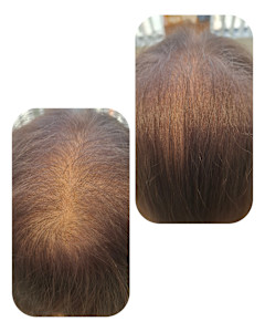 話題のトキカタ♪頭頂部編 - Hair & Spa y‐Forme Ginza掲載