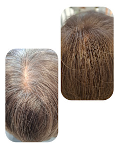 話題のトキカタ♪頭頂部編 - Hair & Spa y‐Forme Ginza掲載