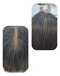 話題のトキカタ♪頭頂部編