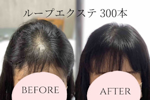 ループエクステ - total beauty IRIS掲載