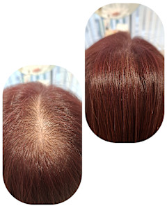 話題のトキカタ♪頭頂部編 - Hair & Spa y‐Forme Ginza掲載