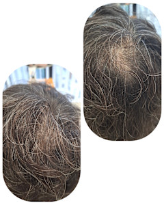 話題のトキカタ♪頭頂部編 - Hair & Spa y‐Forme Ginza掲載