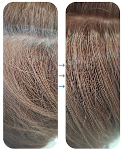 カラーエステ♪白髪ぼかしカラー