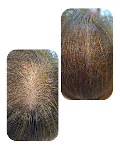 話題のトキカタ♪頭頂部編 - Hair & Spa y‐Forme Ginza掲載