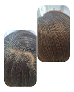 話題のトキカタ♪頭頂部編 - Hair & Spa y‐Forme Ginza掲載