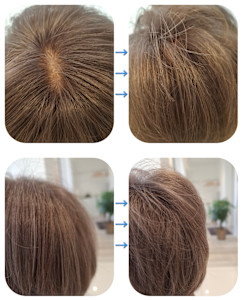 話題のトキカタ♪頭頂部編 - Hair & Spa y‐Forme Ginza掲載