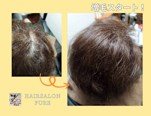 大人のエクステ、ボリュームアップ分け目や渦気にしない！ - Hair Salon Pure掲載
