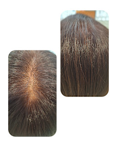 話題のトキカタ♪頭頂部編