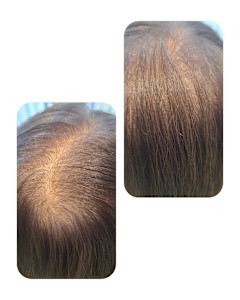 話題のトキカタ♪頭頂部編