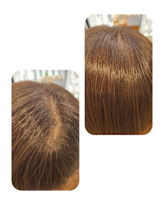 話題のトキカタ♪頭頂部編