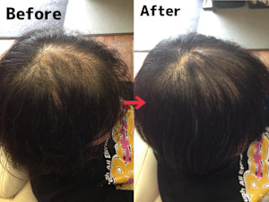 美容院 be shealing×増毛エクステ