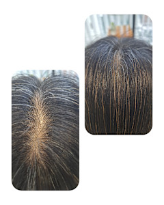 話題のトキカタ♪頭頂部編 - Hair & Spa y‐Forme Ginza掲載