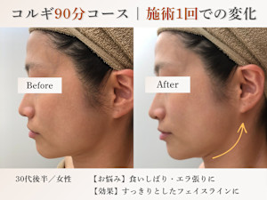 elma〜小顔コルギ/肩こり/毛穴/リンパマッサージ〜(エルマコガオコルギカタコリケアナリンパマッサージ)