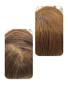 話題のトキカタ♪頭頂部編 - Hair & Spa y‐Forme Ginza掲載