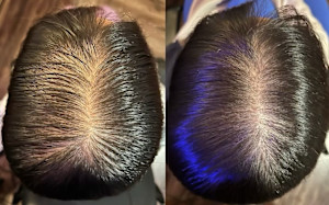 解頭リリース【スペシャル】（シャンプー・ブロー付）