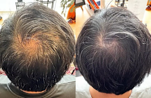 解頭リリース【スペシャル】（シャンプー・ブロー付） - 髪を育てる美養室Soil掲載