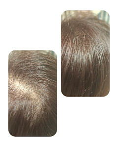 話題のトキカタ♪頭頂部編