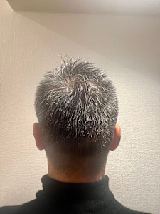 トップ長め刈り上げスタイル