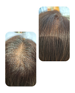 話題のトキカタ♪頭頂部編