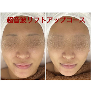 ちゅるん肌.COM 心斎橋店(チュルンハダドットコム シンサイバシテン)