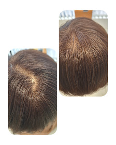 話題のトキカタ♪頭頂部編