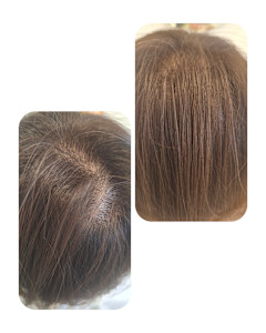 話題のトキカタ♪頭頂部編