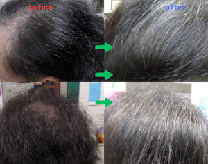 解頭リリース《ベーシック》（シャンプー・ブロー付）