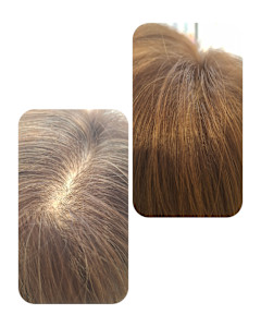 話題のトキカタ♪頭頂部編