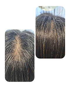 話題のトキカタ♪頭頂部編