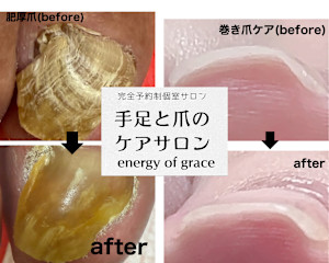 energy of grace(エナジー オブ グレース)