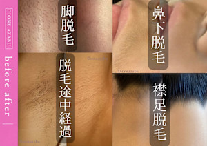美肌脱毛専門サロン Dione 麻布十番店(ビハダダツモウセンモンサロンディオーネアザブジュウバンテン)