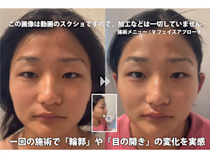Ad Serena(アドセレーナ)