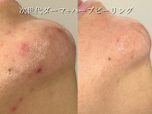 Rairy【ライリー】【美白/ヘッドスパ&イヤーエステ/フェイシャル】(ライリー ビハク ヘッドスパアンドイヤーエステ フェイシャル)