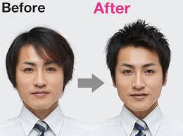 ビフォーアフター！