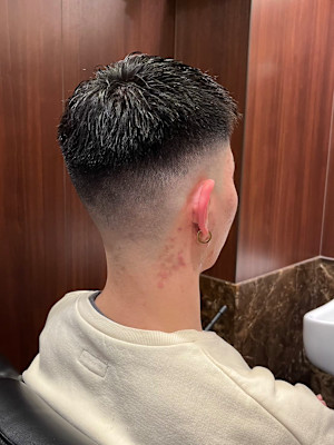 スキンフェード