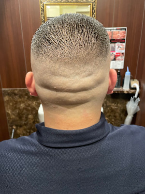 スキンフェード