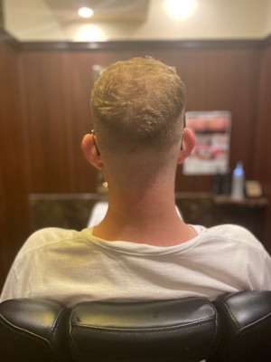 スキンフェード