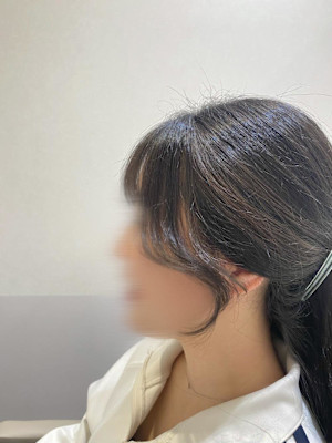 韓国風顔周り☆ SHIZUKU