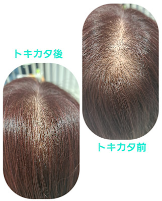 話題のトキカタ♪ふっくらスタイルへ