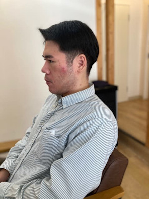 お客様髪質改善データ1531（荒れやすい肌へご提案～）