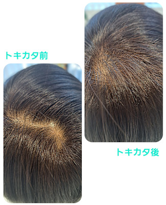 トキカタでパックリ分れ目解消♪