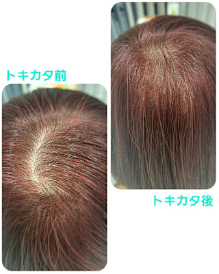 話題のトキカタ♪頭頂部の分け目を解消