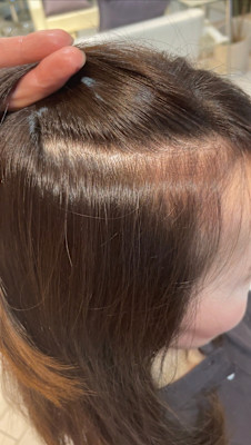 アフター → ビフォア　右にスワイプ【白髪染め/脱白髪染め】