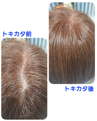 話題のトキカタ♪頭頂部編