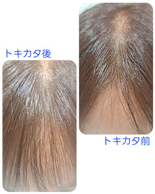 話題のトキカタ♪前髪編