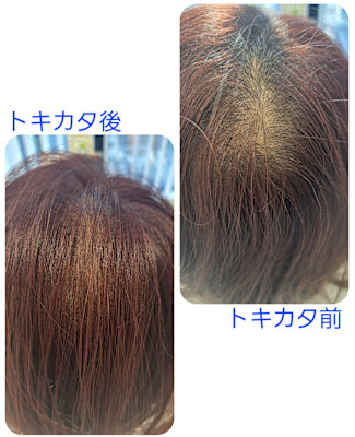 話題のトキカタ♪頭頂部編