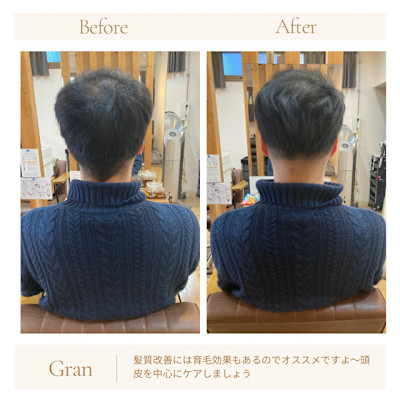 お客様髪質改善データ1621（頭皮ケア髪質改善）