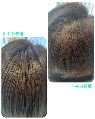 話題のトキカタ♪頭頂部編