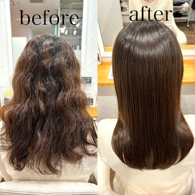 高濃度水素トリートメント